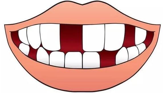 牙齿松动，难以避免的中年危机？慌了