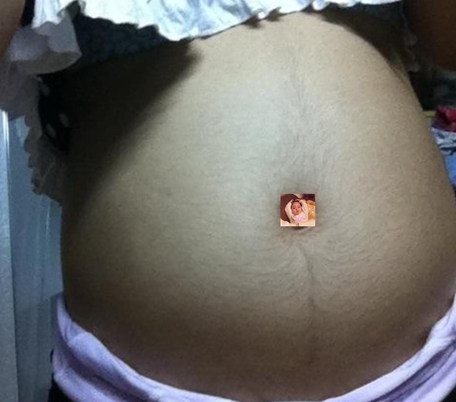 准妈妈孕期肚皮上为什么会长毛？老人说怀的男宝，真的是这样吗？