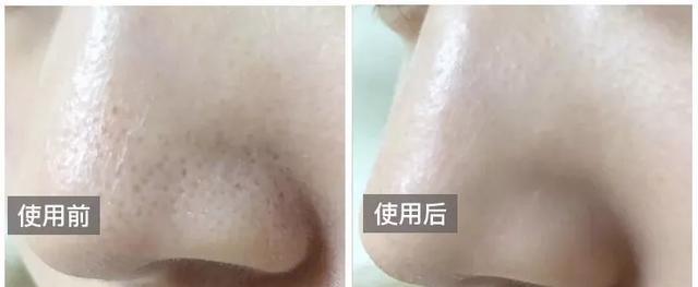 火山泥真是宝,油皮女孩的毛孔疏通剂,让贵妇霜3秒吃透锁水8倍