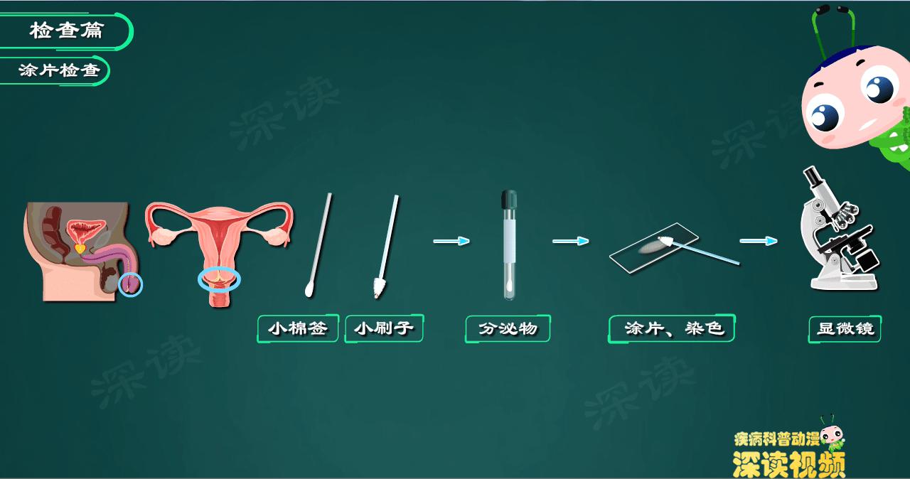 得了淋病就该死吗,得了淋病要干嘛