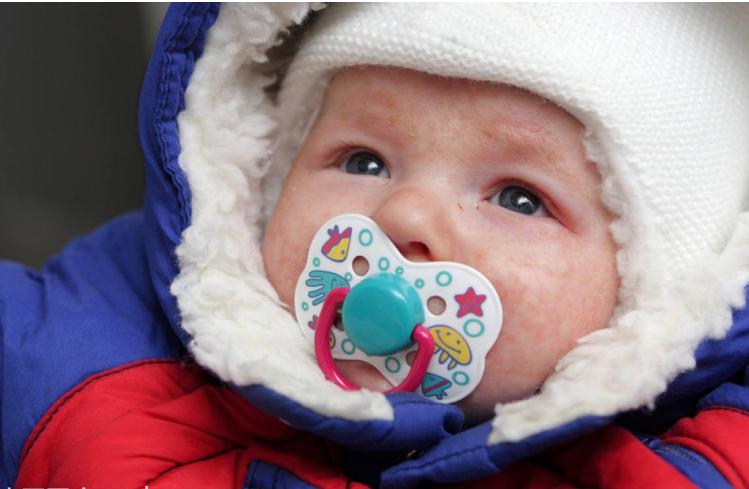 宝宝湿疹反反复复是咋回事,宝宝湿疹一直反复发作是什么原因