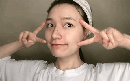 平价实用药膏,平价痘痘药膏推荐