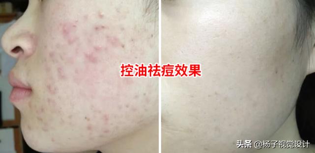 海藻籽面膜的功效与作用机理,什么品牌的海藻面膜好?(配图)