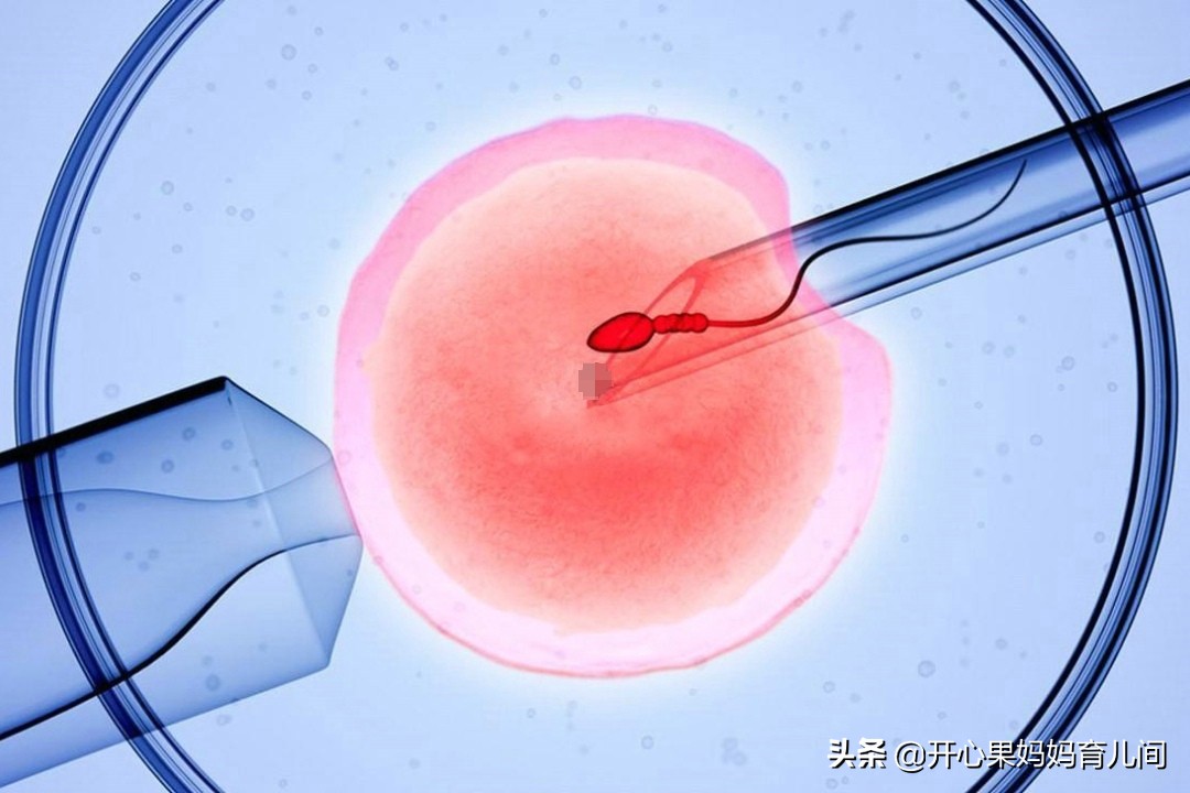一代试管孕30周查出胎儿畸形,试管双胞胎孩子畸形