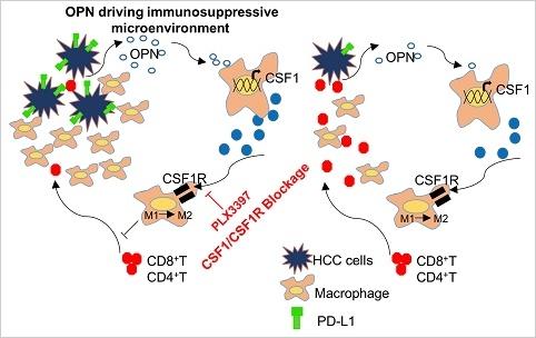 中国医学专家治疗肝癌取得新突破,免疫治疗肝癌科普