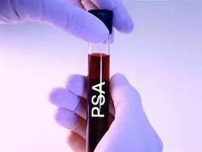 724肿瘤指标高二十倍是癌症吗,肿瘤指标199高一定是癌症吗