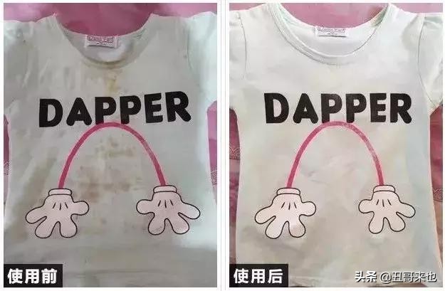 白衣服发黄在家就能处理,衣物变黄如何洗白妙招