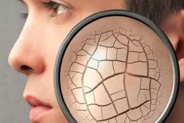 皮肤特别干燥有皱纹咋办,皮肤干燥有细纹的女人吃什么护肤