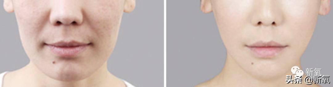 杨超越还能撑多久,杨超越遇到的真实事件