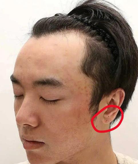 疑似华晨宇女友放锤！曝光其植发整容照，怒斥张碧晨插足当小三