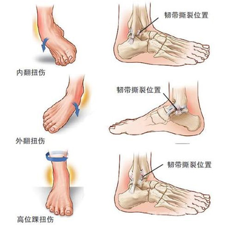 沈杰威北京积水潭医院,北京积水潭医院沈杰威怎么样