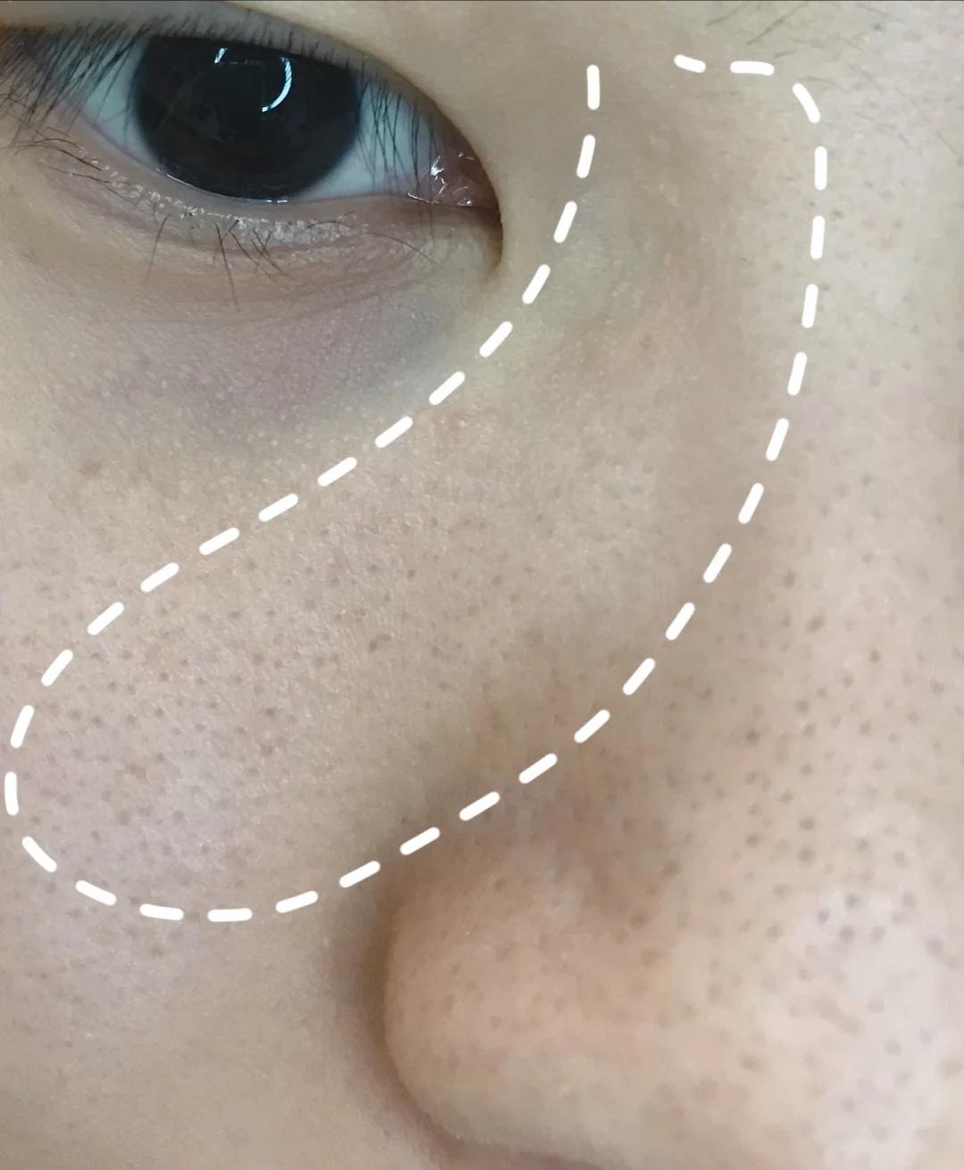 平价好用祛痘印测评,平价又好用祛痘膏有哪些