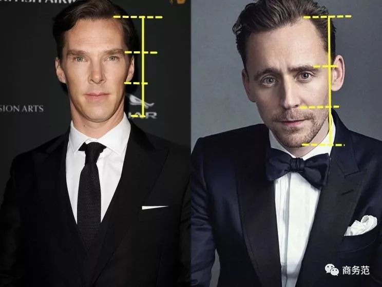 贝克汉姆自曝患上脱发症,贝克汉姆脱发照片