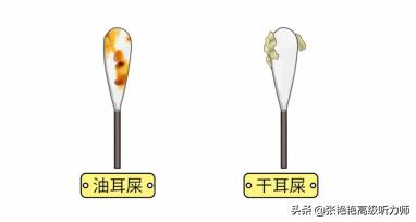 脸上出油耳朵也出油怎么回事,耳朵后面出油发臭是什么原因