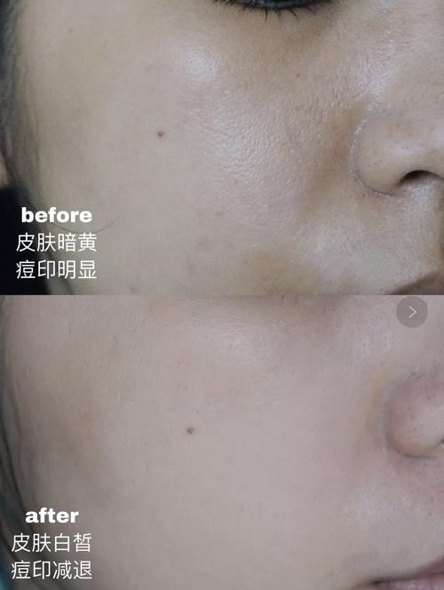 韩束美白面膜免洗吗,韩束面膜透嫩光泽