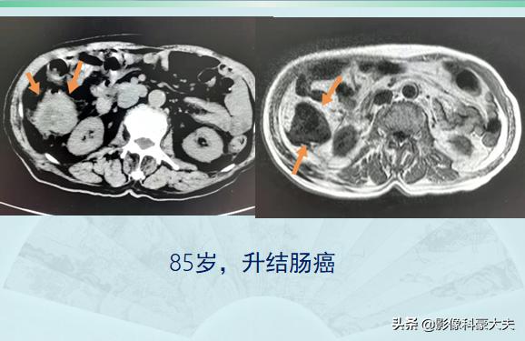 老人去世送盘缠经文,老人死后送盘缠的说法