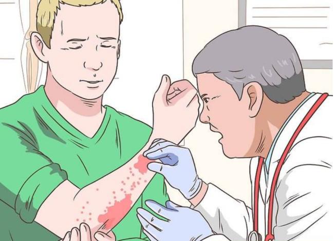 银屑病被称为不死癌症,银屑病真的不死吗