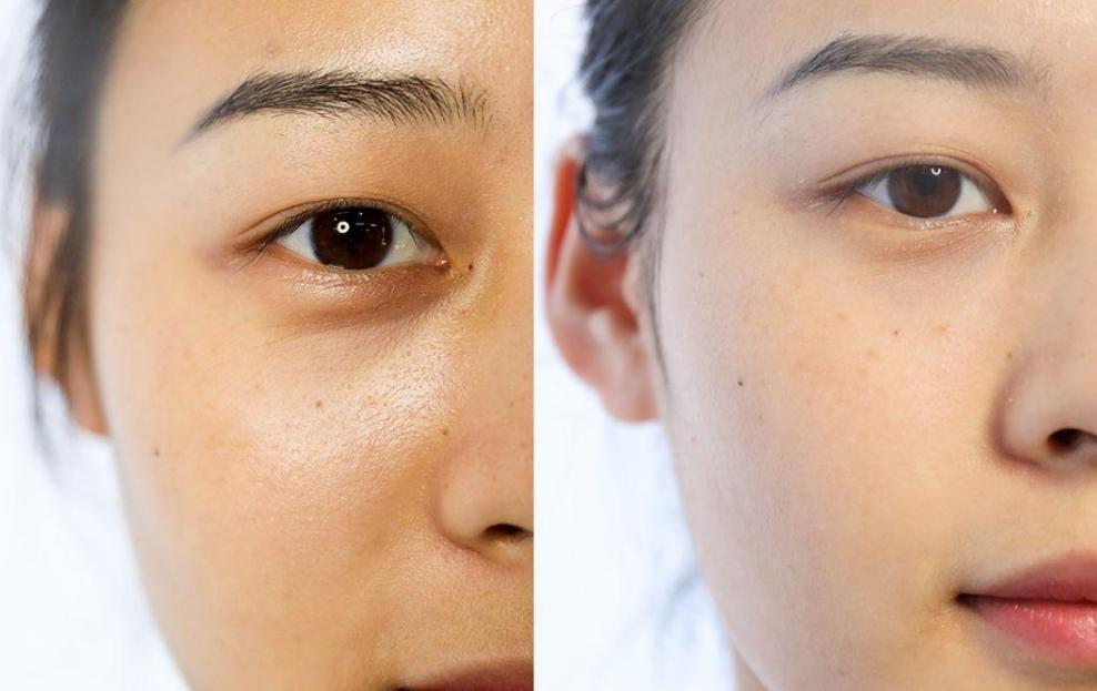 黑眼圈眼袋的最有效的解决方法,眼袋和黑眼圈长一起如何遮住