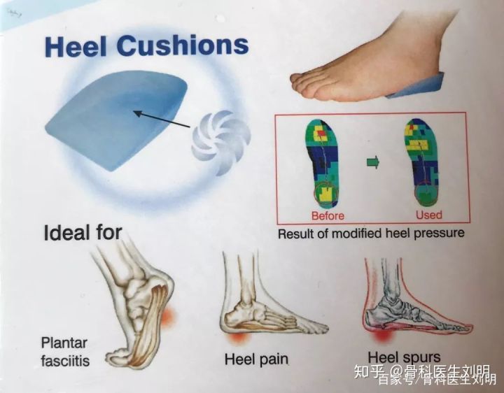 自己怎么按摩足跟,自己怎么调理足跟疼