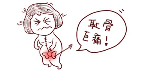 孕期耻骨痛坐骨神经痛,孕妇坐骨神经耻骨痛怎么缓解