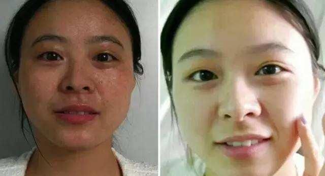 牙膏敷脸可以淡斑吗,牙膏加蜂蜜敷脸有什么效果