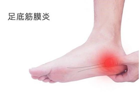 体能恢复训练腿疼怎么办,跳绳体能改善