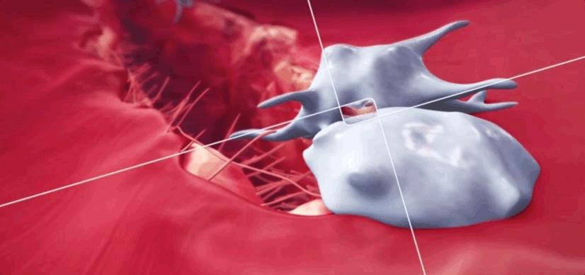 血小板破裂是什么意思,血小板凝固原因