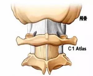 面对颈椎病—如何做个“聪明外行”