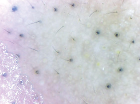 别折腾了，你这样去黑头是没有用的！