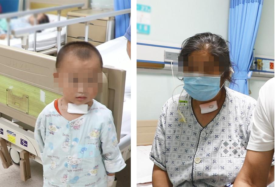 梨状窝瘘相关知识,梨状窝瘘可以慢慢治愈吗