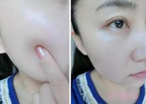 药店有一种“佑颜神药”,皮肤越擦越白嫩,关键不贵,遇到别错过