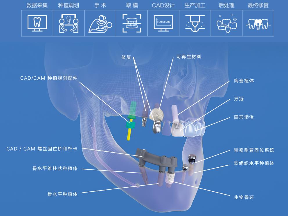 士卓曼种植牙成功率高不高,士卓曼种植牙说明书