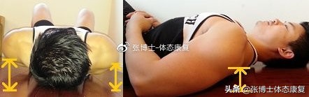 【体态矫正】耸肩、圆肩体态的矫正训练方法
