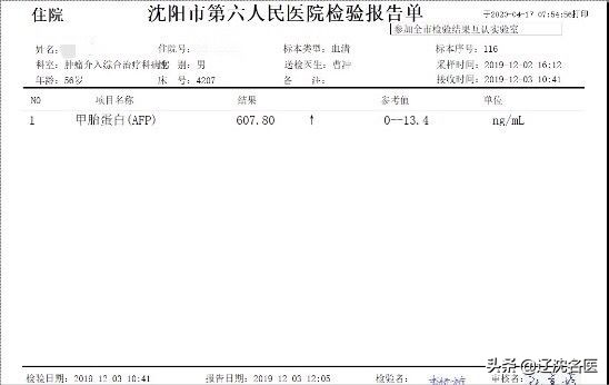 肝癌做放射性粒子治疗有什么影响,乏力查出来癌症