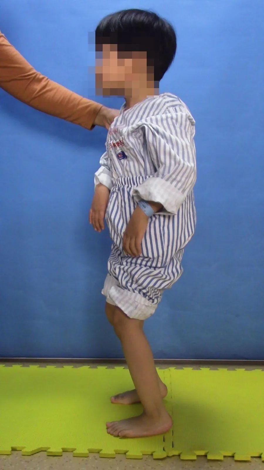 手术康复一体化,脑瘫康复训练10个方法图片