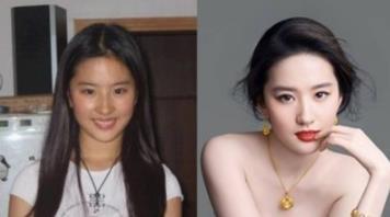 白醋洗脸可以美颜,女生用白醋洗脸