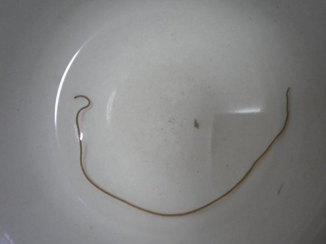 野钓鱼身上有没有寄生虫怎么看,钓上来的鱼会不会有寄生虫