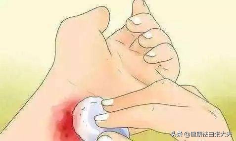 当针清碰上淋雨：陕西21岁女子为了相亲清闭口，却养出来白癜风