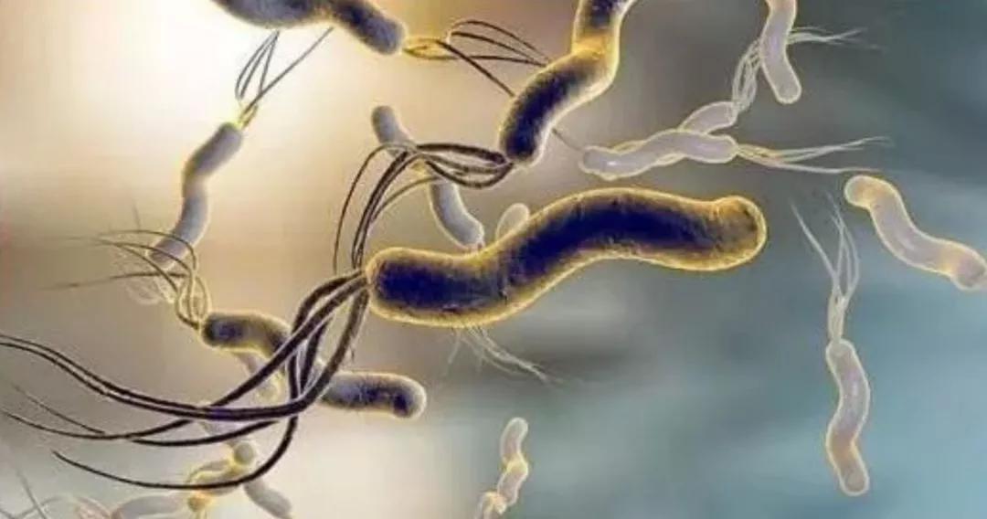 幽门螺杆菌阳性900多严重吗,幽门螺旋杆菌900能引起胃癌吗