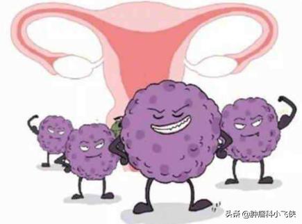 感染hpv就一定会得宫颈癌吗,hpv感染隐瞒犯法吗