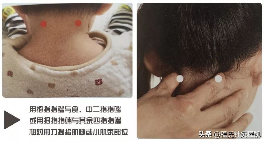 秋季孩子身上起荨麻疹怎么办,秋季小孩出麻疹