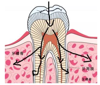活动牙烤瓷牙全瓷牙种植牙,一颗牙坏了要换三颗烤瓷牙纠结