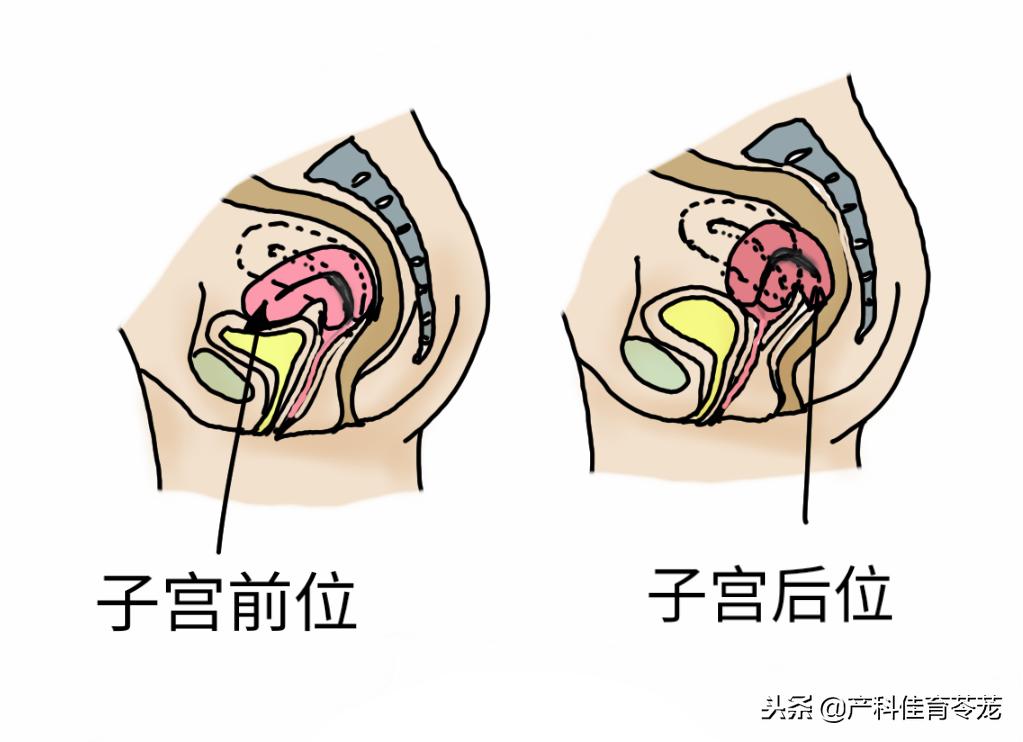 打b超能看出子宫内膜的问题吗,经腹妇科彩超分辨子宫前后位