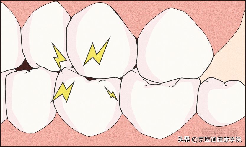 一招解决磨牙的危害,磨牙很严重最好的磨牙解决方法