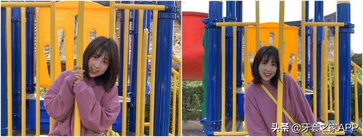 不靠整容怎么改变下巴后缩？看这里