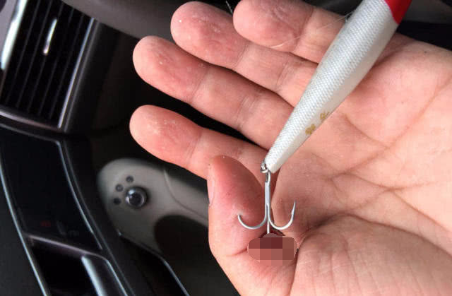 钓鱼鱼钩进喉咙里怎么办,野外钓鱼鱼钩刺入手指怎么办