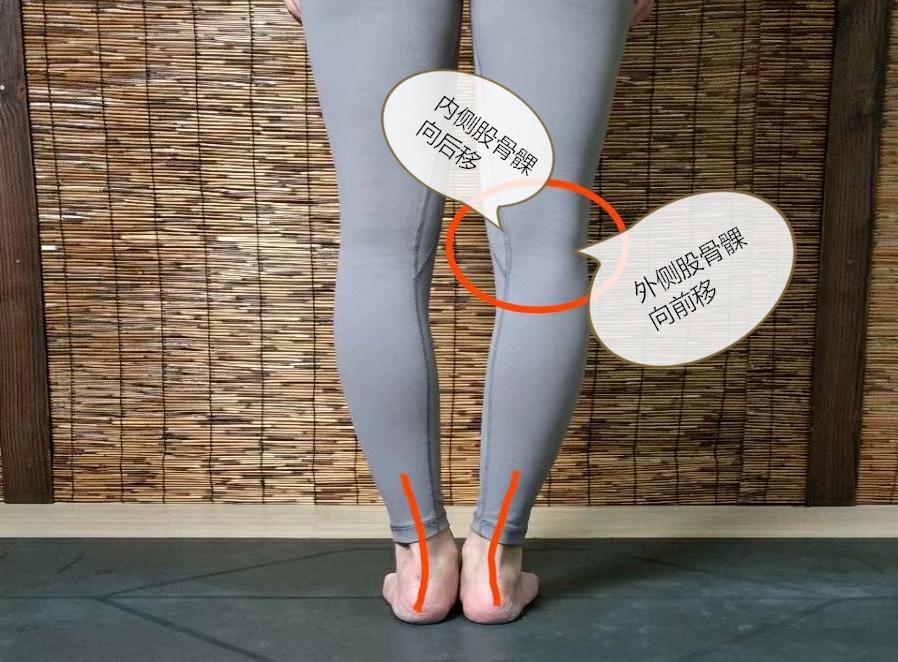 小腿外侧粗改善动作,改善小腿粗的方法站立