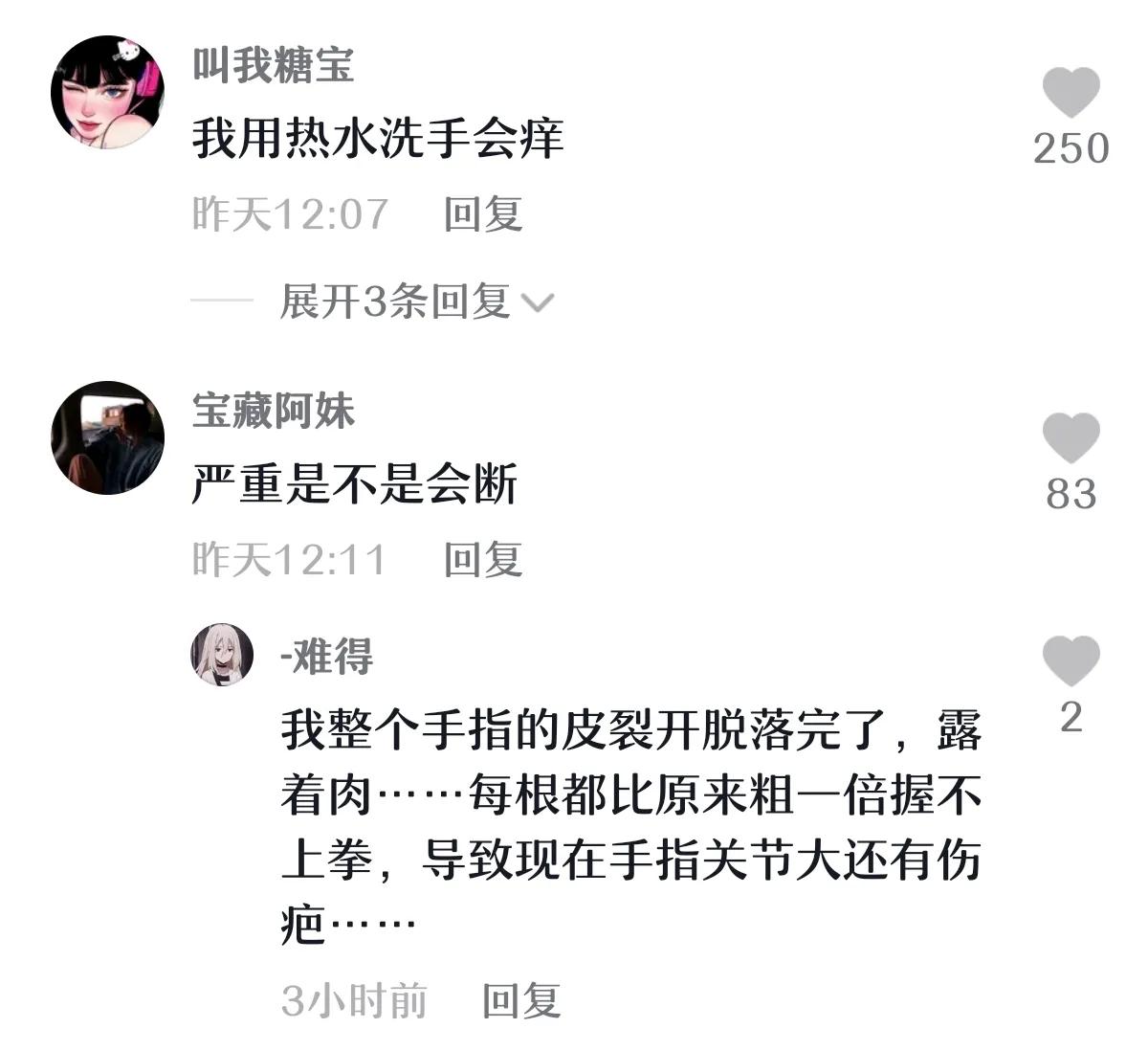 手冻僵后怎么处理才不会生冻疮,手冻僵了用热水洗会冻疮吗