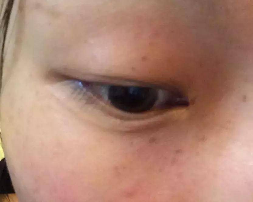 只需3步淡化斑点,简单4招快速淡化色斑