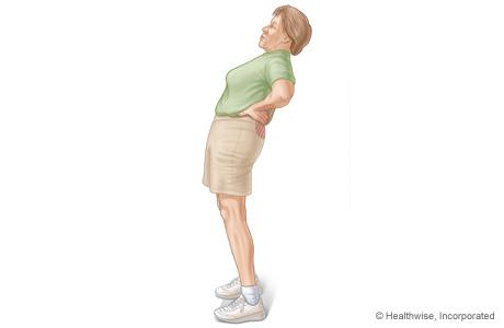 腰椎管狭窄有什么症状怎么样治疗,腰椎管狭窄是怎么引起的如何治疗